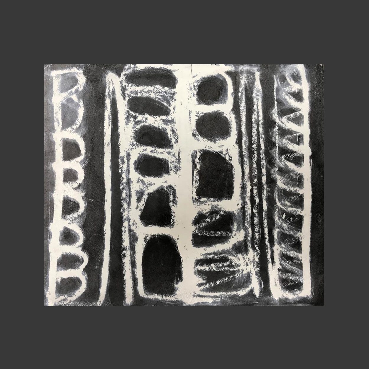 X-ray